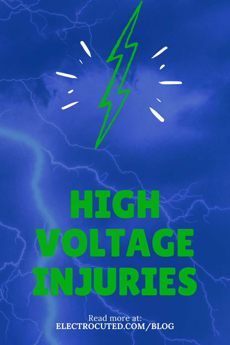 High voltage injuries: What you need to know