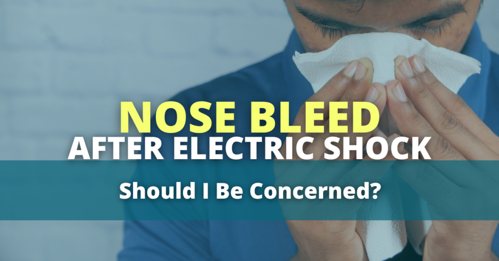 Nose bleed after electric shock: Should I be concerned? 
